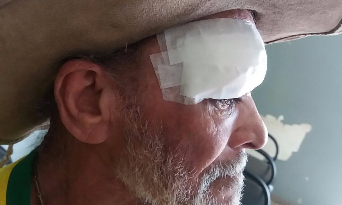 Criminosos invadem casa de senhor de 67 anos e o agridem com barra de ferro
