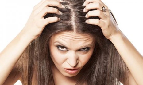 Caspa: o que é, como tratar e dicas para diminuir esse problema definitivamente