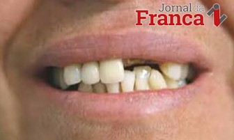 Homem espanca e deixa a mulher “banguela” no Jardim Ipanema em Franca