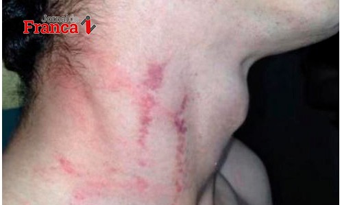 Após ameaçar a mãe, menina é espancada pelo pai no Jardim Parati