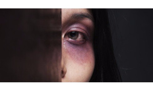 Mulher é espancada pelo ex namorado após pedir R$ 30 para pagar conta