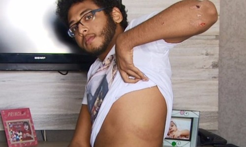 Jovens alegam terem sido chamados de “macacos” e agredidos pela polícia