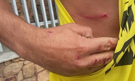Policial Militar aposentado saca arma dentro de escola durante briga com professor