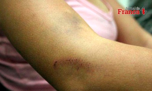 Após agredir a esposa com panela de arroz, pedreiro vai parar atrás das grades