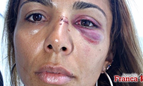Nos 10 anos da “Maria da Penha”, mulheres de Franca convivem com o medo