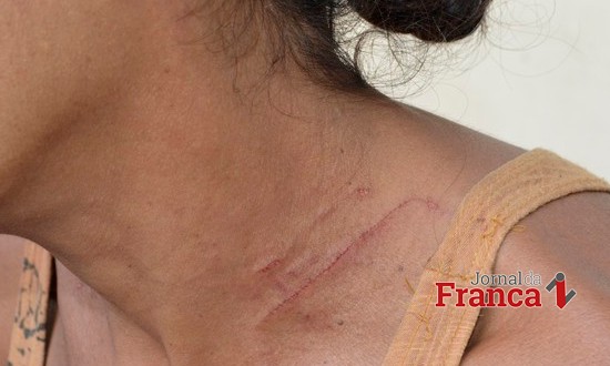 Depois de fumar maconha, filha espanca a mãe com ajuda do primo no Jd. Luiza