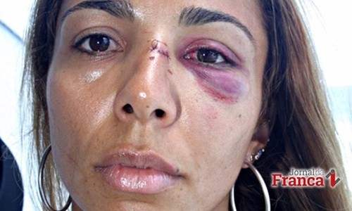Garantido o atendimento especializado no SUS para vítimas de violência sexual