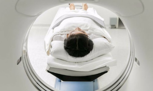 País tem mais de 10 mil novos casos por ano de tumores do sistema nervoso