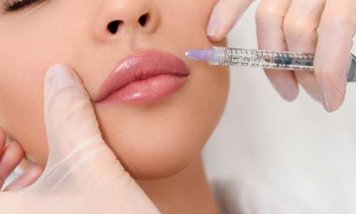 Preenchimento facial: com a popularização, surgem novos riscos à saúde
