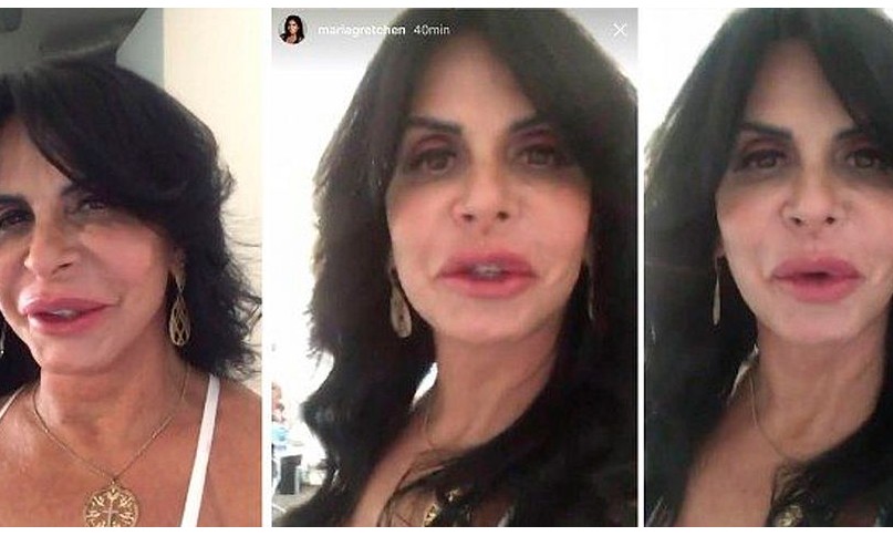 Cantora Gretchen exibe resultado de preenchimento labial: ‘Amo minha boca assim’