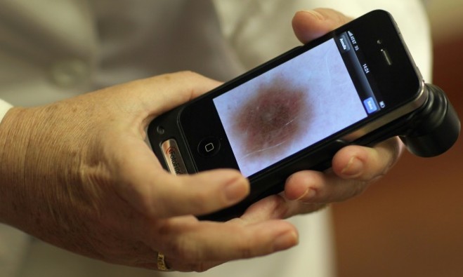 Computador consegue detectar melhor câncer de pele que dermatologistas