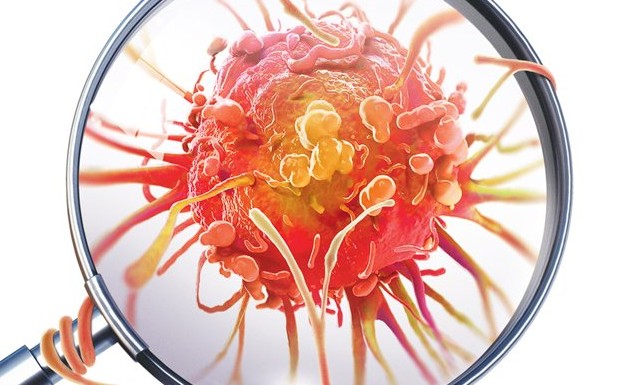 Câncer de estômago ganha primeiro tratamento dentro da imunoterapia