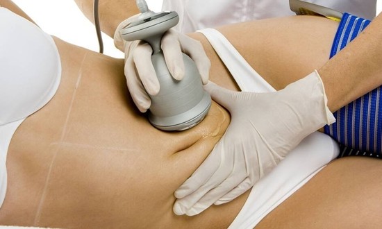 Lipocavitação ajuda a eliminar indesejáveis gordurinhas localizadas