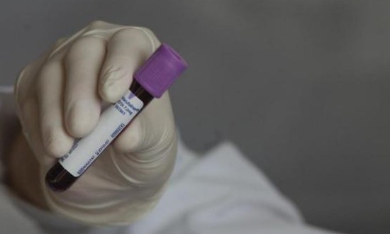 Lei isenta doadores de medula óssea de taxa em concursos públicos