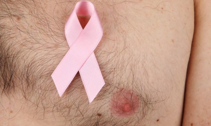 Preconceito dificulta diagnóstico de câncer de mama em homens