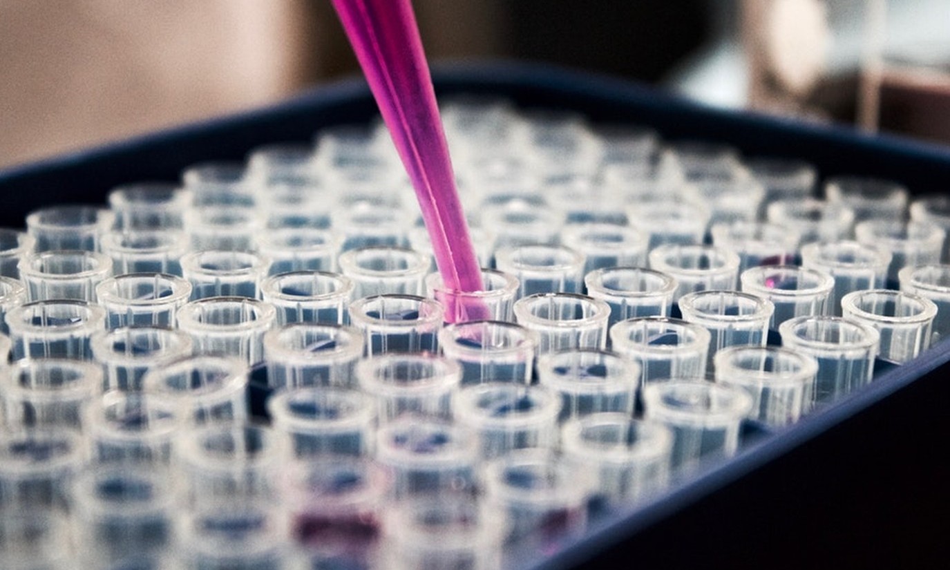 Técnica com célula-tronco indica possível tratamento para endometriose