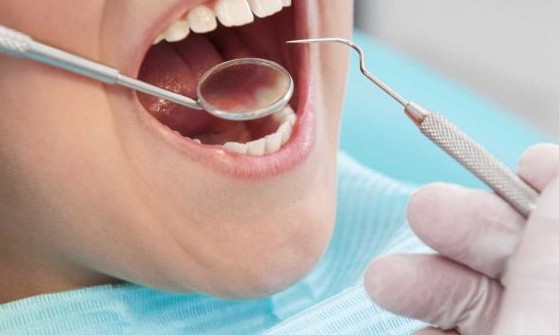 Câncer de boca deve atingir 14,7 mil novos casos no país este ano
