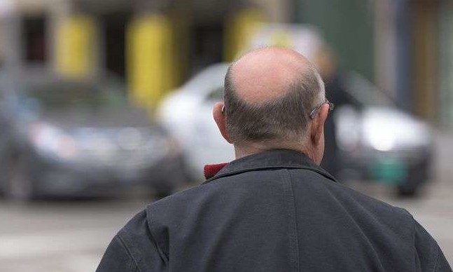 Anvisa suspende venda de tônico capilar usado contra queda de cabelo