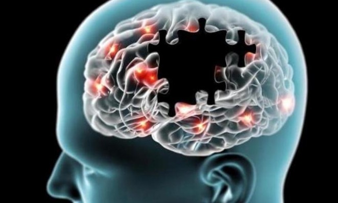 Depressão acelera envelhecimento cerebral, comprova novo estudo