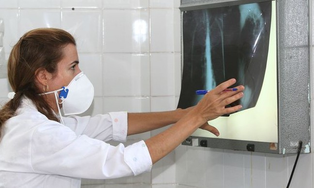 Tuberculose mata 4.500 pessoas diariamente em todo o mundo
