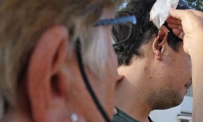 Cirurgia plástica é alternativa para pessoas com orelhas proeminentes
