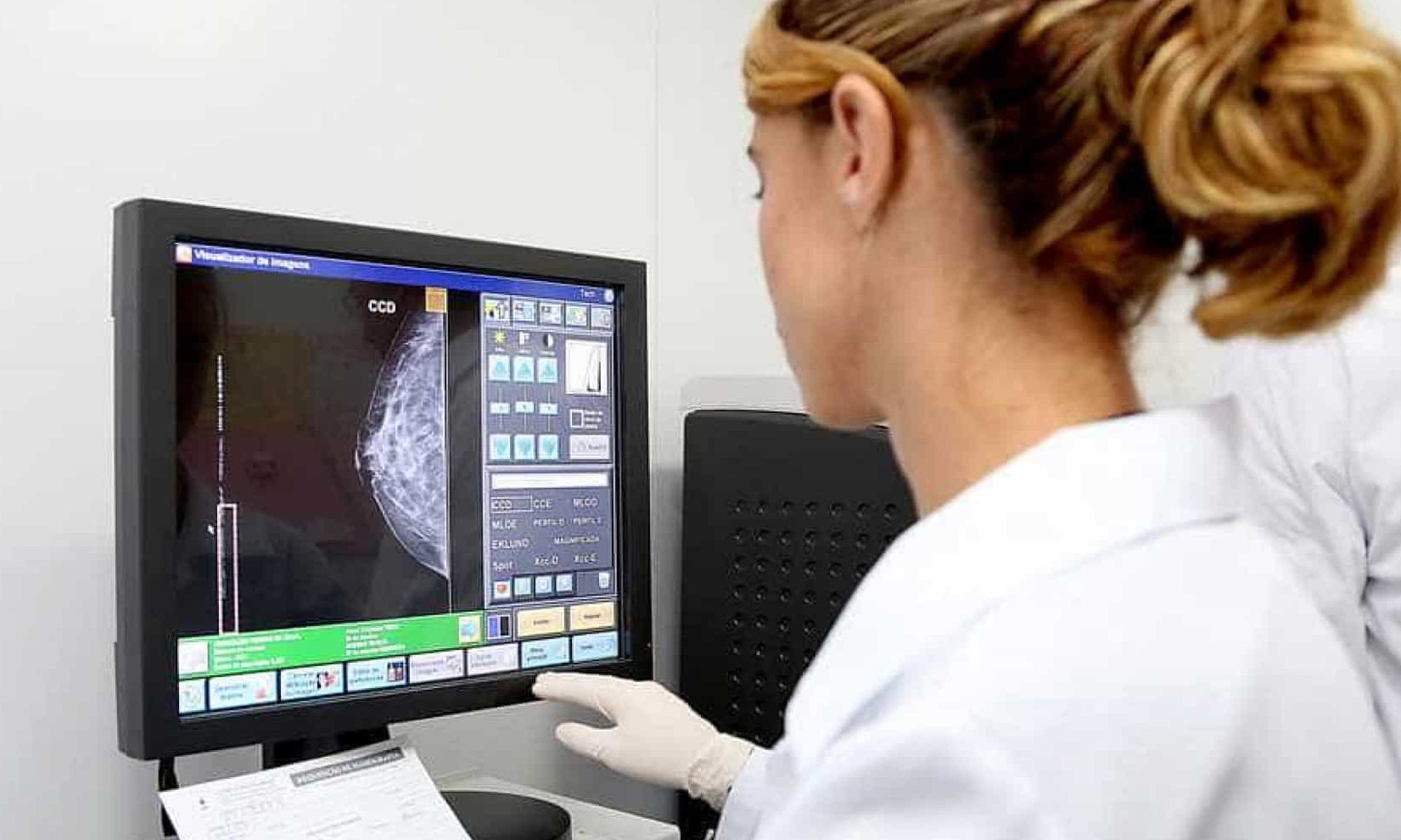 Câncer de mama tem primeira imunoterapia aprovada no Brasil