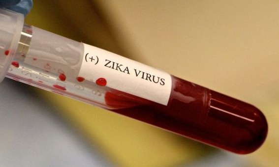 Zika: bebês podem apresentar sequelas até 2 anos após o nascimento