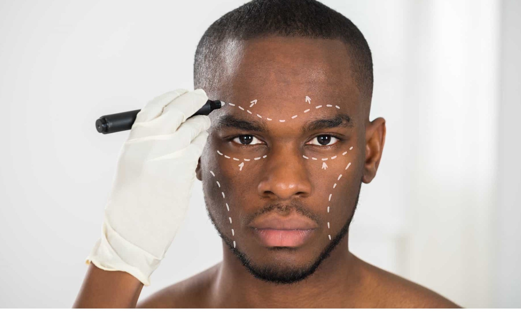 Número de homens que procuram por cirurgia plástica é cada vez maior