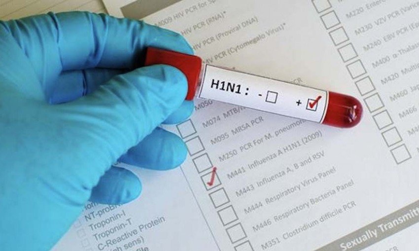 Franca já tem dois casos positivos da gripe H1N1 e seis ainda sob suspeita