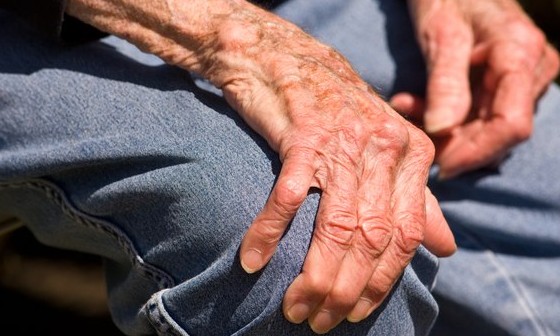 Muitas pessoas sofrem de deficiência da vitamina D, mas nem imaginam
