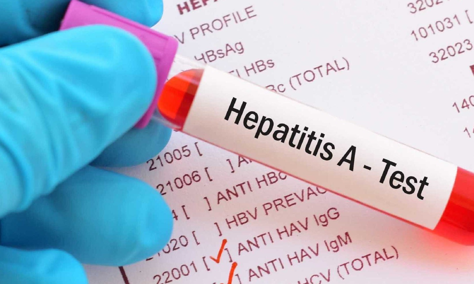 Número de pacientes com hepatite cresce 20% nos últimos 10 anos no Brasil