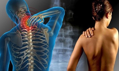Pesquisa inédita mostra que 35 mil brasileiros sofrem esclerose múltipla