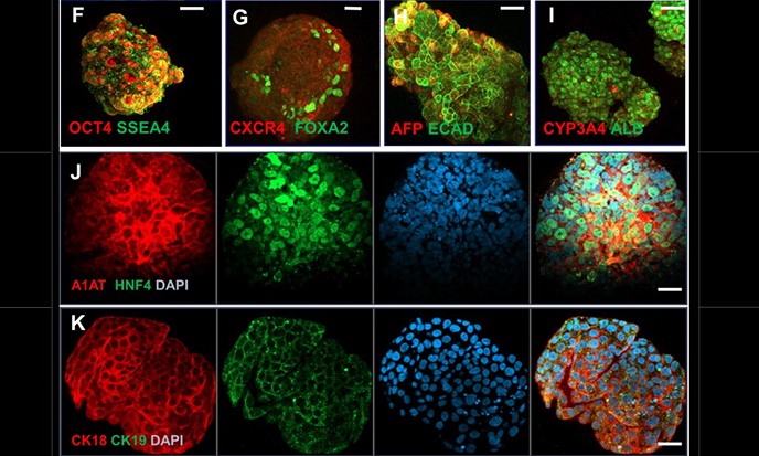 Célula-tronco e impressão 3D produzem tecido para transplante de fígado