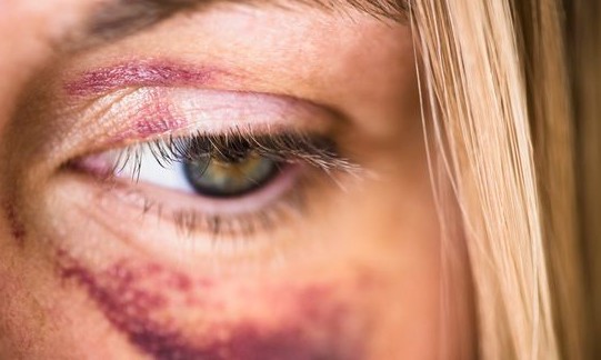 Médicos serão obrigados a informar à polícia casos de violência contra mulher
