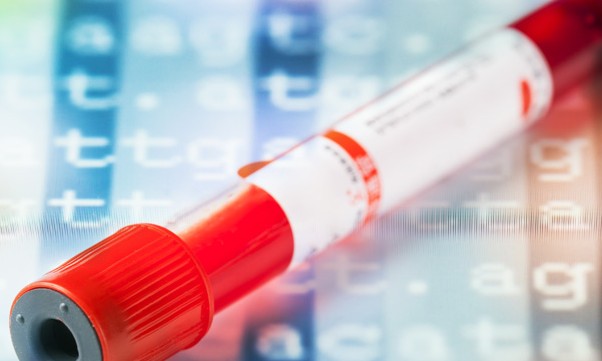 Sintomas comuns dificultam e atrasam diagnóstico de tipo de câncer do sangue