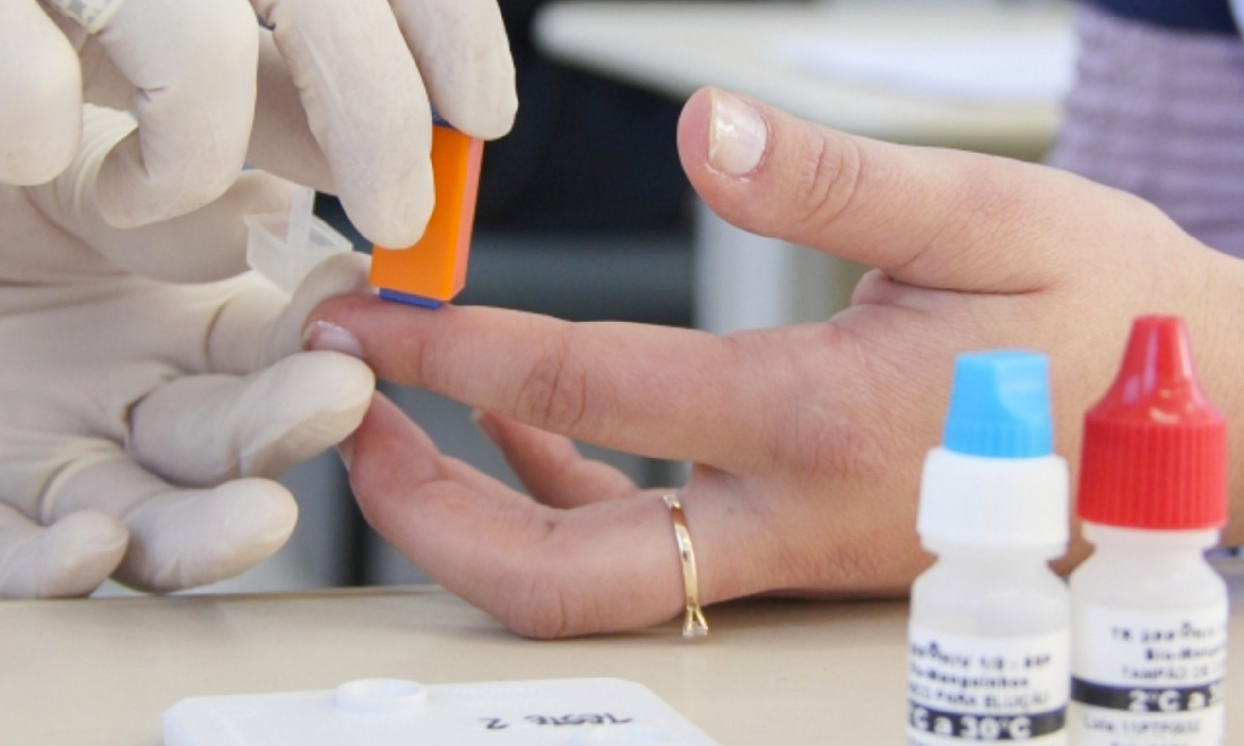 Governo de SP realiza maior campanha de testagem de HIV do Brasil