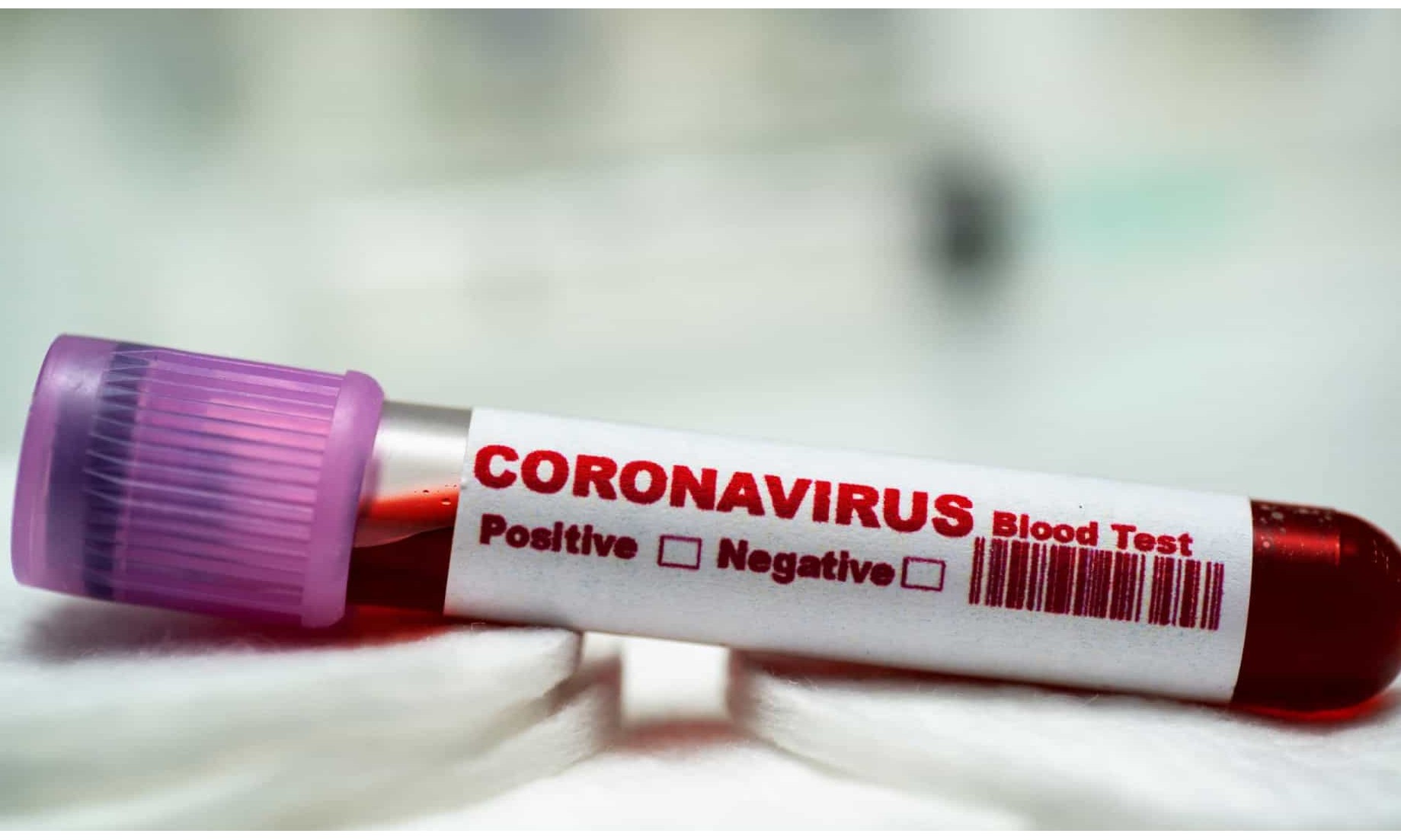 Polícia prende 14 pessoas flagradas com mais de 15 mil testes de coronavírus