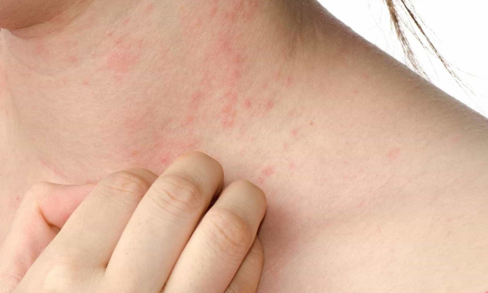 Os produtos naturais e orgânicos são melhores para as peles sensíveis?