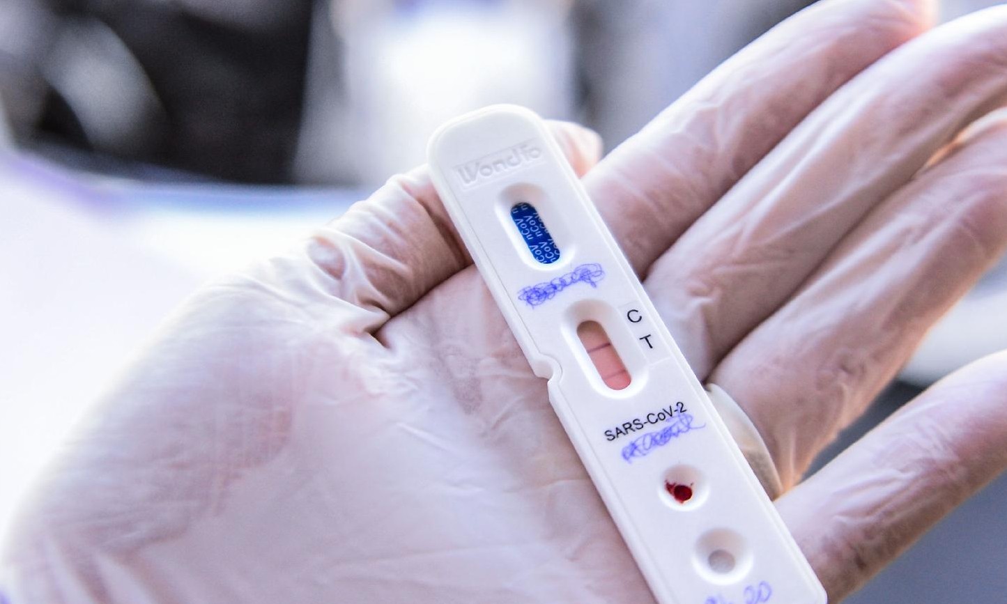 Saúde: Testagem rápida para detecção da Covid-19 será ampliada em Ituverava