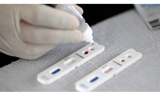 Covid-19: ANS torna obrigatória cobertura de teste por planos de saúde