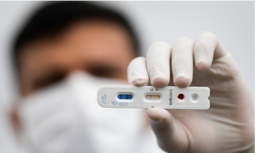 Com importantes parcerias, Franca aplicará 40 mil testes gratuitos contra a covid-19