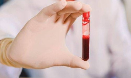 Sangue tipo O tem menos chance de testar positivo para Covid-19, diz estudo