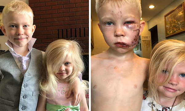Herói de 6 anos salva irmã de ataque de cachorro, recebe 90 pontos e elogios