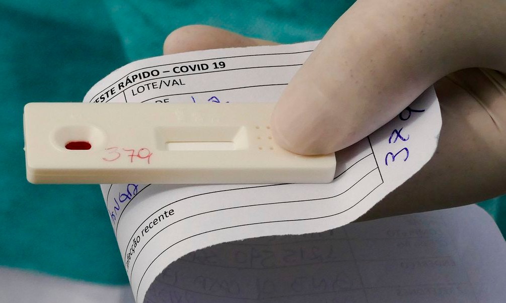 Servidor com covid-19 poderá pedir carência no pagamento do consignado