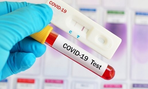 ANS suspende medida que obrigava planos de saúde a cobrir teste de coronavírus