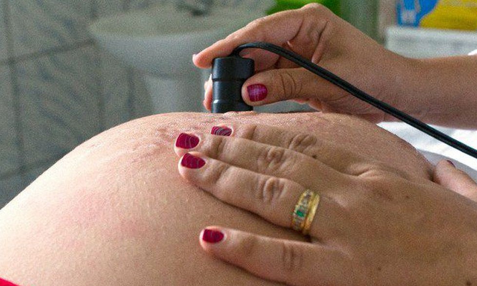 Lei que autoriza cesária sem motivo médico é inconstitucional, diz TJ