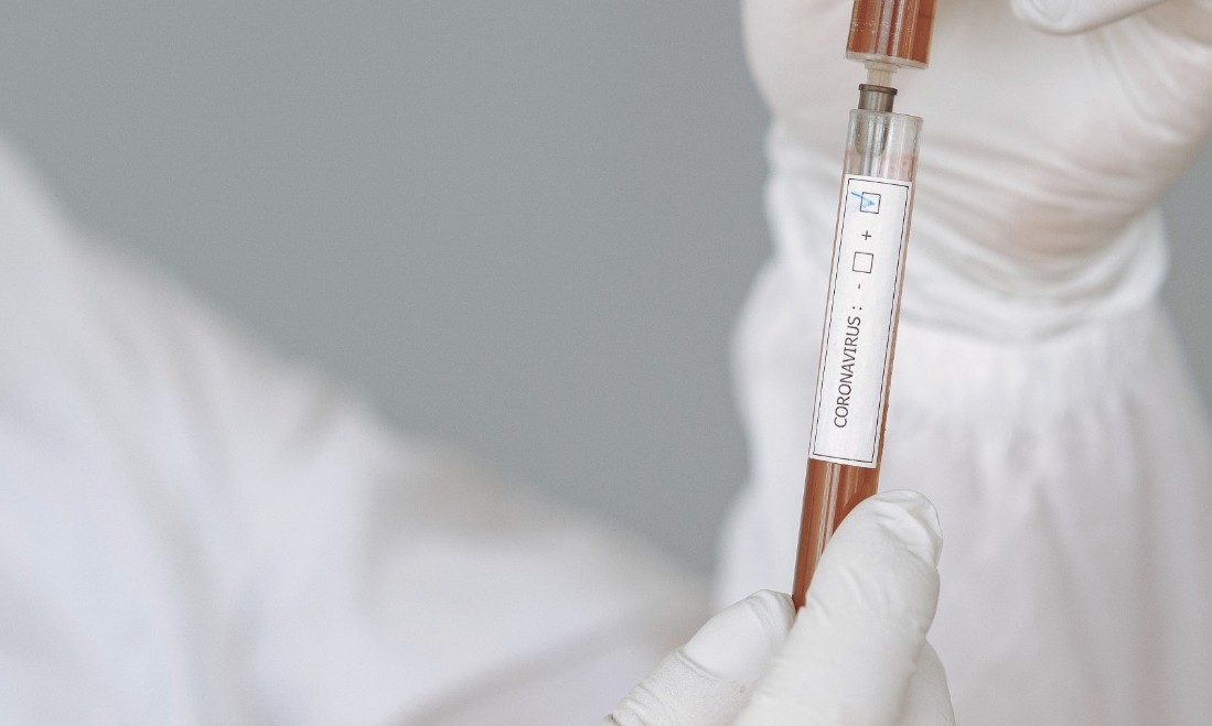 Hospital Unimed Franca registra mais 13 novos casos de covid-19 nesta 6ª, 24