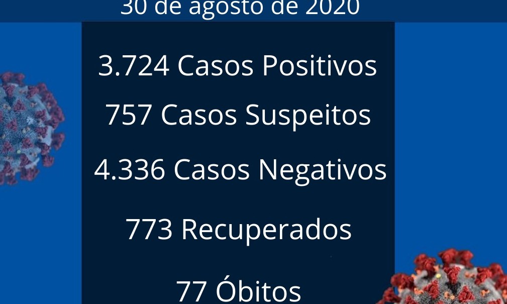Franca registra neste domingo, 30, 2 óbitos e 14 novos casos de coronavírus