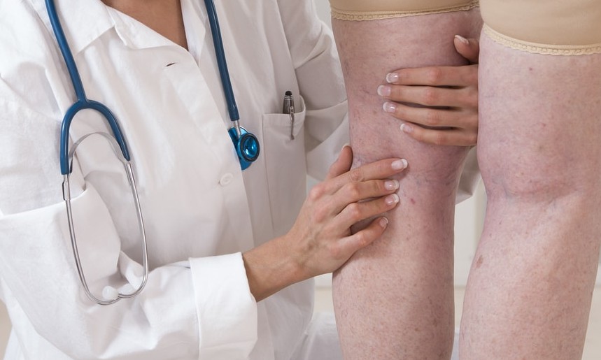 Mesmo com pandemia, doenças vasculares precisam de cuidados