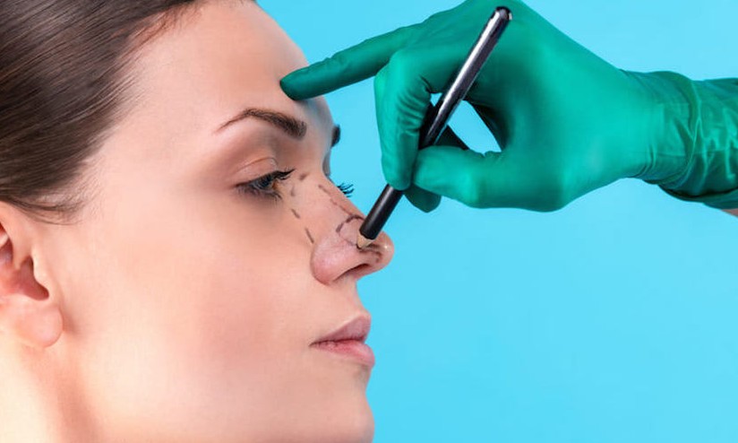 Descubra por que a procura por rinoplastia aumentou 4.800% na pandemia